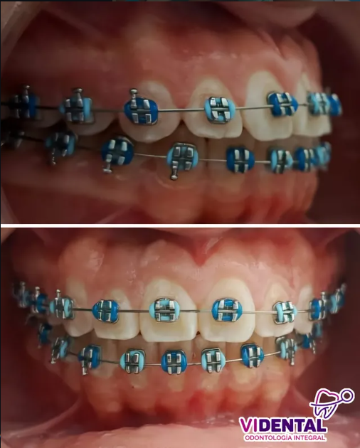 Imagen de Ortodoncia